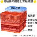 胃がんの原因の99％！ピロリ菌除去は保険診療（健康保険）の対象！